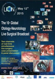 La X videoconferencia mundial LION Global Otology – Neurotology Live Surgical Broadcast en el Centro Mundial Auditivo en Kajetany