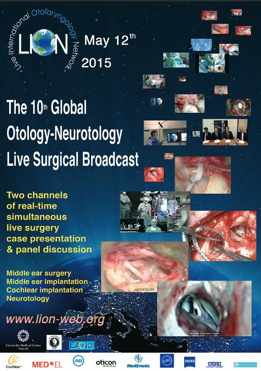 LION: the 10th Global Otology – Neurotology Live Surgical Broadcast in the World Hearing Center in Kajetany on 12 May, 2015